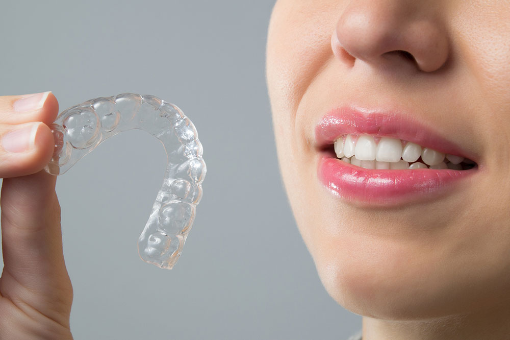 Clear Braces Vs. Metal Braces