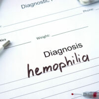 6 Lifestyle Tips for Managing Hemophilia