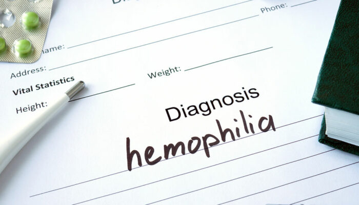 6 Lifestyle Tips for Managing Hemophilia