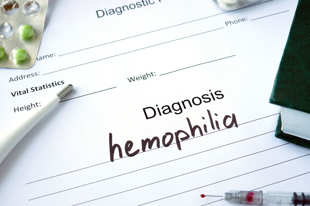 6 Lifestyle Tips for Managing Hemophilia